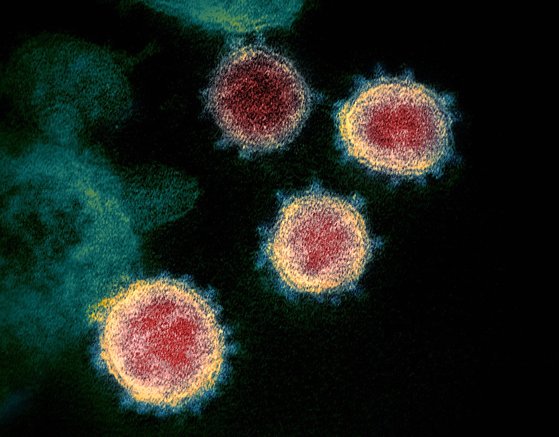 코로나19 바이러스 전자현미경 사진. 중앙포토