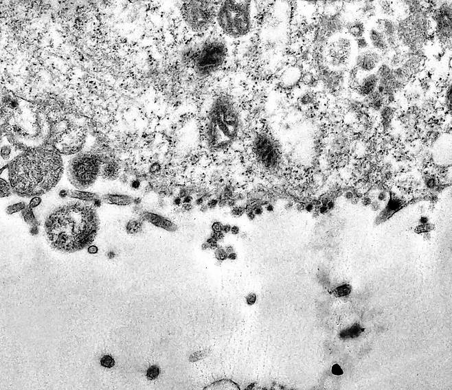 아래 검은 점으로 보이는 코로나19 바이러스가 위에 있는 세포에 침입하기 위해 다가가고 있다. (사진출처=피오크루즈 재단 홈페이지)© 뉴스1