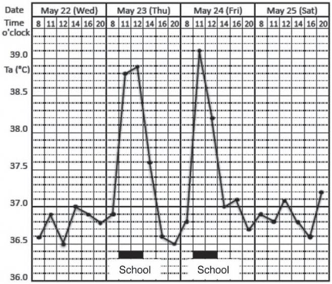 학교생활에서 스트레스를 받아 심인성 발열 증상을 보이는 15세 소녀의 심부 체온(겨드랑이에서 측정) 그래프다. 학교에 머무는 동안 평소보다 체온이 2도나 높다. ′온도′ 제공