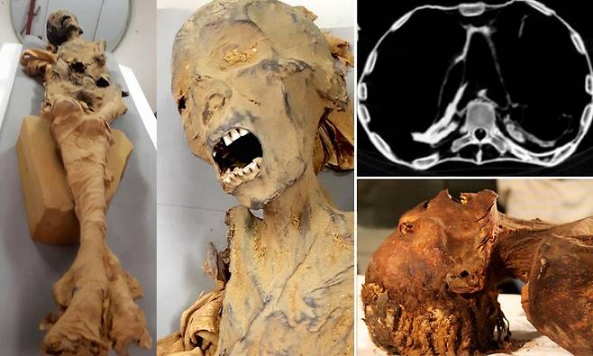 3000년 전 이집트 ‘절규하는 여성 미라’의 비밀…CT 검사로 밝혀졌다