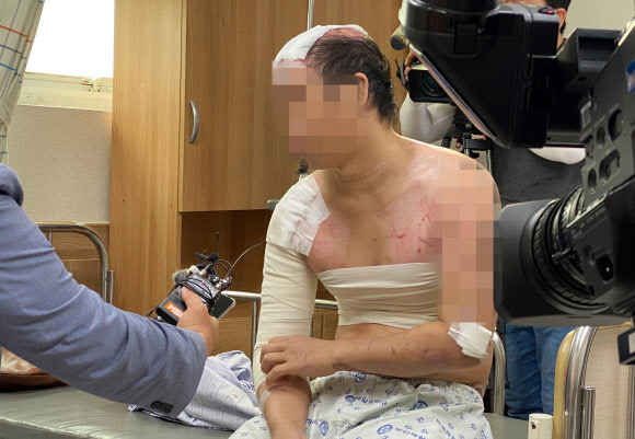 고문 같았던 가혹행위 증언하는 피해자 - 중학교 후배와 그의 여자친구로부터 수개월 동안 고문 수준의 가혹행위를 당한 피해자가 17일 낮 전남 무안군 한 종합병원병실에서 기자들에게 참혹했던 경험을 증언하고 있다. 피해자는 경기도 평택시의 한 주택에서 후배 연인으로부터 오랜 기간 가혹행위를 당해 두피가 벗겨지고 온몸에 화상을 입는 피해를 봤다. 경찰은 가해자인 남녀를 붙잡아 구속영장을 신청했다. 2020.7.17 연합뉴스