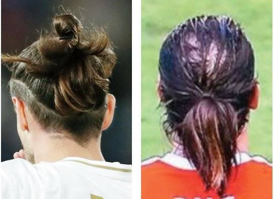 2016년 베일의 탈모 상황이 TV 화면에 잡혔다. 베일은 머리카락을 더 길러 꽁지를 만들었다. 방송화면 캡쳐