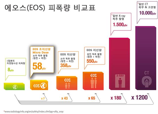 이오스(EOS) 피폭량 비교표/사진=부민병원 제공