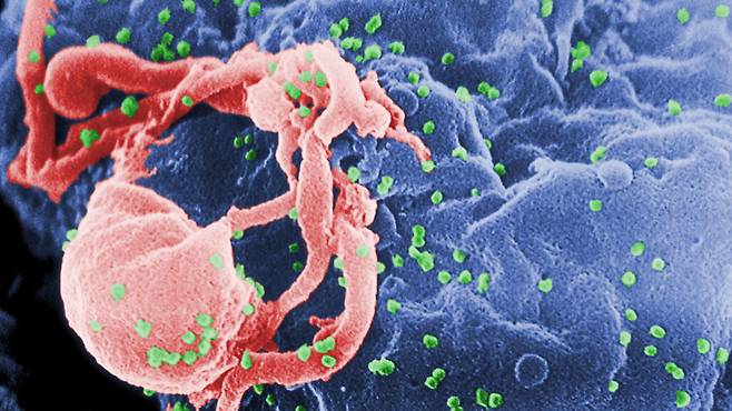 세포 위에 보이는 녹색 입자가 에이즈 바이러스. 특정 형질을 지닌 사람은 에이즈 유전자를 활성이 낮은 유전자 사막에 봉할 수 있다.(사진=CDC)