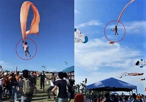 30일 연날리기 축제에 참여했다가 연줄에 묶였던 3세 여아. 연합뉴스