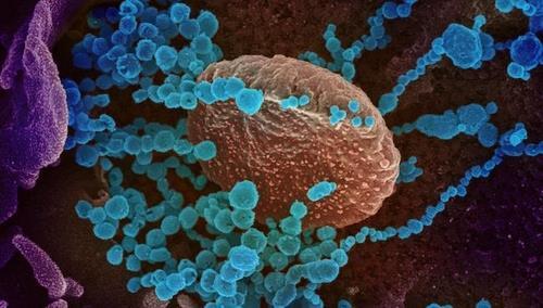 신종 코로나바이러스  배양 세포 표면에서 나오는 신종 코로나바이러스(청색)의 전자현미경 이미지  [미 NIAID 제공 / 재판매 및 DB 금지]