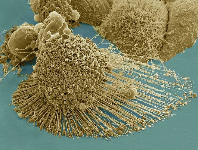 전 세계 연구실에서 실험에 쓰이는 헬라 세포의 전자현미경 사진. 1951년 사망한 미국 흑인 여성 헨리에타 랙스에게서 채취한 세포를 계속 증식시킨 것이다./위키미디어