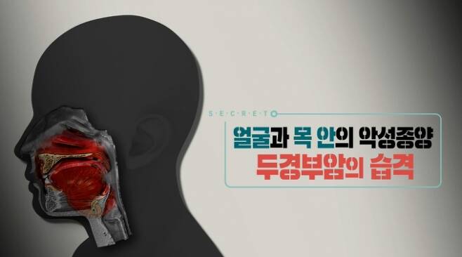 '생로병사의 비밀' [KBS 1TV]
