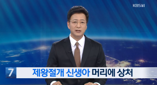 23일 KBS에 따르면, 대구의 한 병원에서 지난 16일 제왕절개 수술 도중 수술용 칼로 신생아 머리에 5cm 정도의 상처를 내고 꿰맨 뒤 곧바로 아기의 부모에게 알리지 않았다. 사진=KBS뉴스 방송화면 캡처.