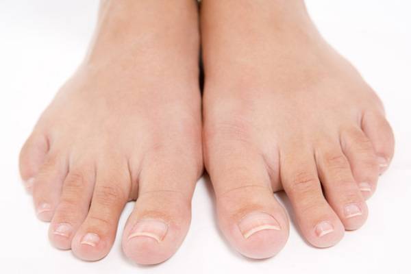 내향성 발톱은 발톱 바깥 부분 살이 지속적으로 눌리며 발생한다./사진=게티이미지뱅크