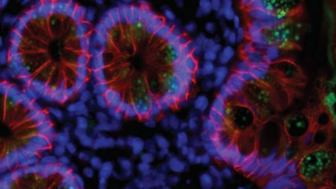 장 세포에 있는 코로나바이러스의 흔적들(초록색)은 인체의 항체가 바이러스를 더 잘 인지하도록 훈련시키는 데 도움이 될지 모른다. 사진=바이오아카이브(bioRxiv) 제공