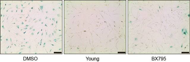 노화된 세포, 젊은 세포, PDK1 억제를 통해 역노화된 세포.(자료=한국과학기술원)