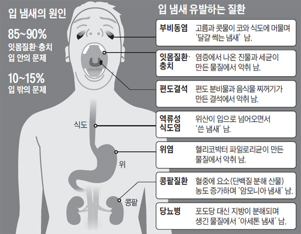 입 냄새는 각종 질환의 신호가 될 수 있다./사진=조선일보 DB