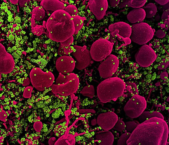 미국 국립보건원(NIH) 산하 알레르기·전염병연구소(NIAID) 통합연구시설(IRF)에서 전자현미경으로 촬영한 코로나19 바이러스(녹색)에 심하게 감염돼 사멸한 세포(선홍색)의 모습을 나타낸 이미지.(사진=NIAID/NIH)