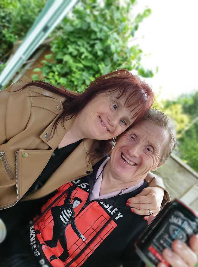 세계 최초의 다운증후군 부부인 토미 필링(오른쪽)과 아내 매리앤. © 뉴스1