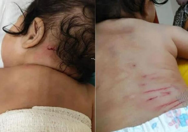 지난달 20일 조호르주타만 누사 다마이의 한 가정집에 침입한 야생 원숭이는 생후 5개월 된 여자 아기를 공격하고 달아났다.