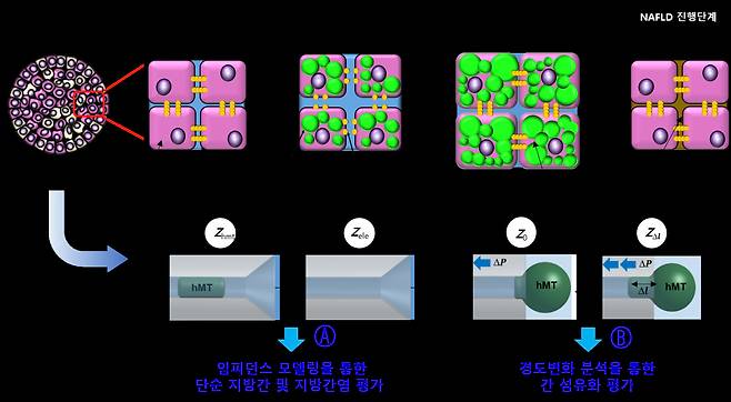 비알코올지방간질환과 임피던스 분석 모형.[안전성평가연구소 제공]