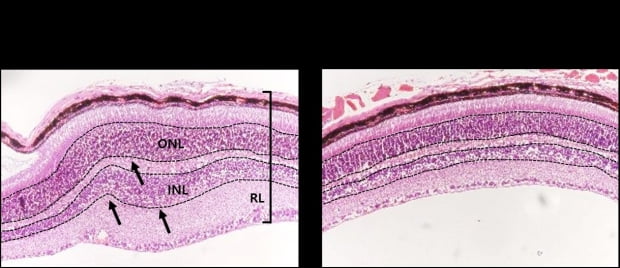 유베이티스 동물모델에서 염증으로 두꺼워지고 딱딱해져 변형된 망막층 및 붕괴된 내·외 과립층 안구구조(왼쪽)를 iCP-NI가 회복시킴(오른쪽).