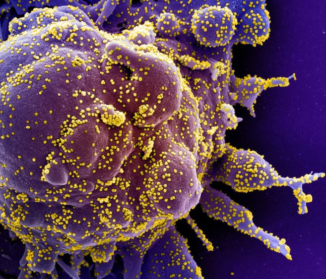 신종 코로나바이러스 감염증(COVID-19·코로나19)을 일으키는 바이러스의 모습. 미국 국립알레르기전염병연구소(NIAID) 제공