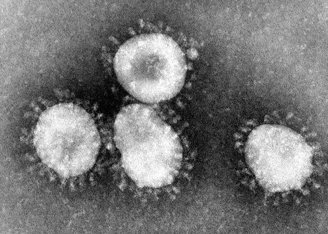 코로나19 바이러스 (사진=위키백과)