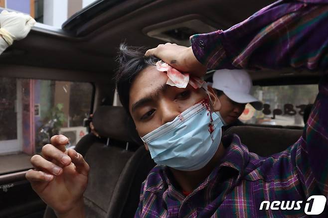 미얀마 제2도시 만달레이에서 2021년 2월 20일 군부 쿠데타 항의 시위에 참가한 한 남성이 군·경의 강경 진압으로 머리에 부상을 입고 피 플리는 모습. © AFP=뉴스1