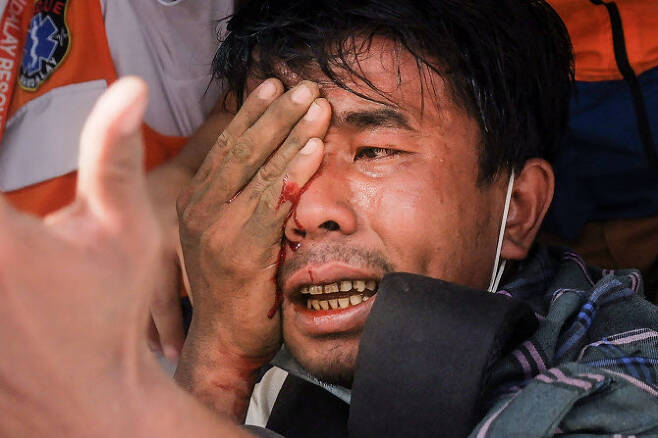 20일 만달레이에서 열린 시위에 참여한 남성이 군경에 공격받은 후 눈에서 피를 흘리고 있다(사진=AFP)