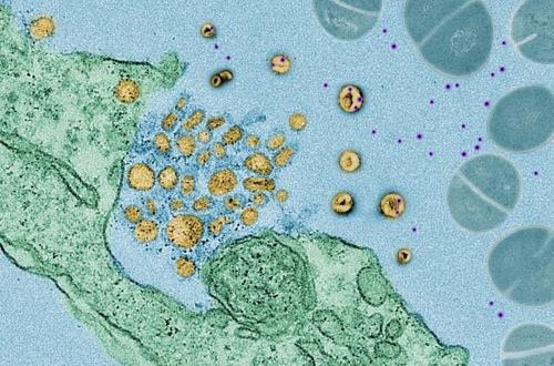 인간의 폐 세포 엑소좀 폐 세포(녹색)에서 세균 독소(자주색)를 빨아들이는 엑소좀(노란색)    [미 뉴욕대 켄 카드웰 교수팀 '네이처' 논문 캡처 / 재판매 및 DB 금지]