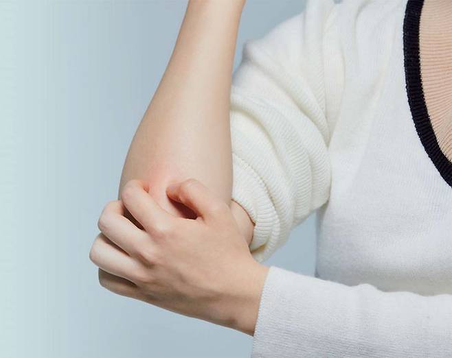 아토피 피부염은 흔히 소아기 질환으로 알려져 있지만 최근에는 성인에서 증가하는 추세다. 특히 성인 아토피는 목과 얼굴 부위 등에 많이 나타나 우울감 등으로 이어지는 경우도 잦다. 전문가들은 전문 치료 외에도 집먼드기 제거와 침구 세탁 등과 같은 환경 개선이 병행돼야 한다고 조언한다. 게티이미지뱅크 제공