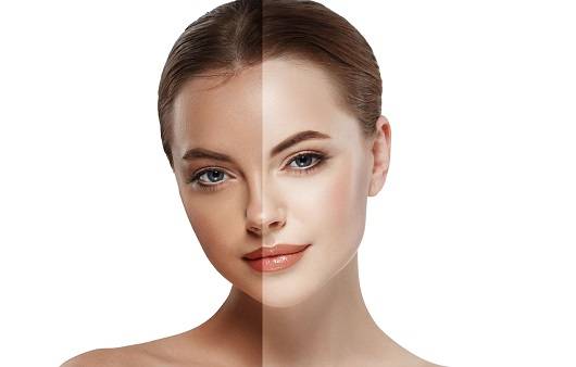 태닝과 화이트 태닝