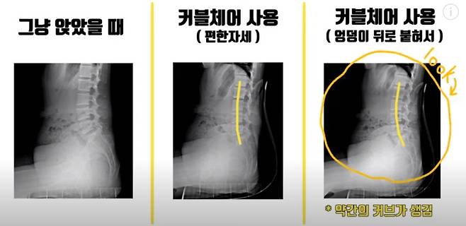 /사진=유튜브 채널 '닥터고은'