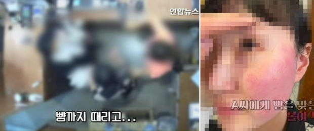 폭행 혐의로 경찰 조사를 받고 있는 주한 벨기에 대사 부인에게 뺨을 맞은 피해자인 옷가게 점원과 가족이 볼이 부은 사진과 폭행 당시 CCTV 영상을 20일 공개했다. /사진=연합뉴스