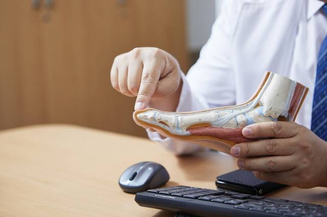 무지외반증은 엄지발가락이 두 번째 발가락 쪽으로 과도하게 휘는 것으로, 휘어있는 각도가 20도 이상일 경우 무지외반증으로 진단한다. 30도가 넘으면 수술 치료를 고려해야 한다./사진=신지호 헬스조선 기자