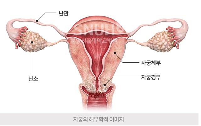 난소 및 자궁경부 암 발생 부위