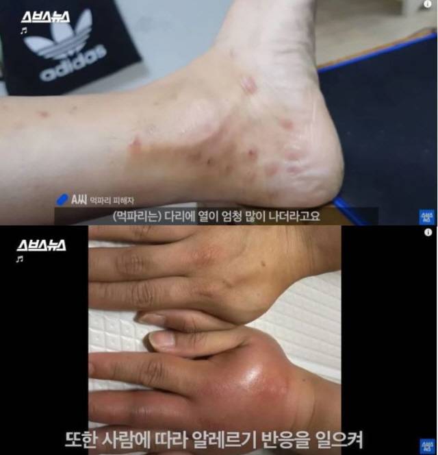 흡혈파리에 물리면 모기에 물리는 것보다 훨씬 아프고, 상처도 오래가는 것으로 알려졌다./사진=스브스 영상 캡처