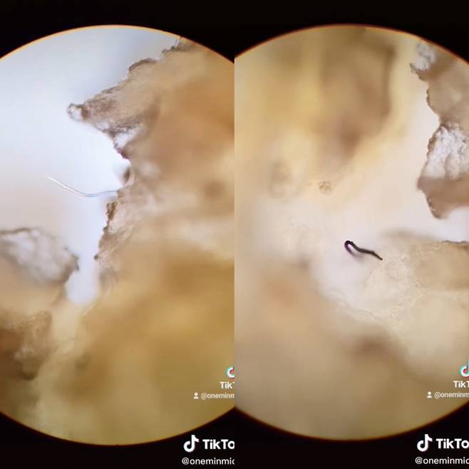 흔히 먹는 냉동 생선살에 미세 플라스틱 조각이 박혀 있는 모습이 공개돼 충격을 주고 있다. /사진='oneminmicro' 틱톡 캡처