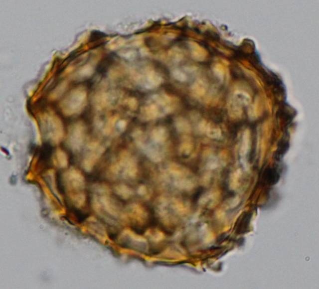 경복궁 유구에서 나온 기생충알. 문화재청 제공