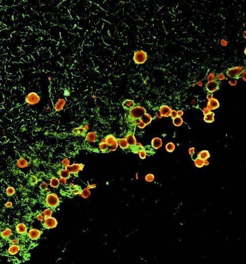 파킨슨병 환자의 뇌에 많은 녹말 양소체  파킨슨병은 중뇌 흑질의 도파민 분비 뉴런이 사멸해 생기는 신경 퇴행 질환이다.
파킨슨병 환자나 고령자의 뇌에선 변형된 녹말 양소체가 많이 발견된다.
정상 구조의 녹말 양소체는 뇌의 폐기물 용기로 쓰인다.
[스페인 바르셀로나대 제공/ 재판매 및 DB 금지]