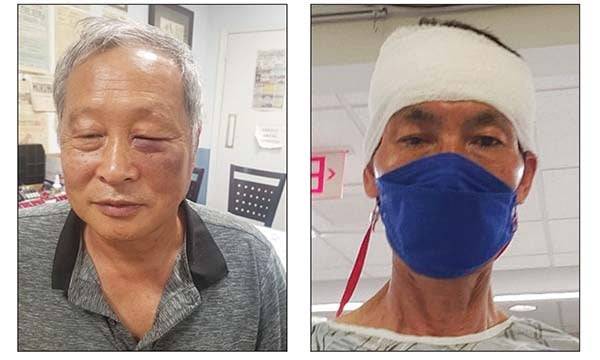 미국 뉴욕 한인야구협회장을 맡고 있는 한재열 회장(왼쪽)과 박우하 이사장은 지난 9일 뉴욕 한인 밀집지역인 플러싱에서 아마존 배달 직원으로부터 이유없는 폭행을 당했다. 한 회장 및 뉴욕한국일보 제공