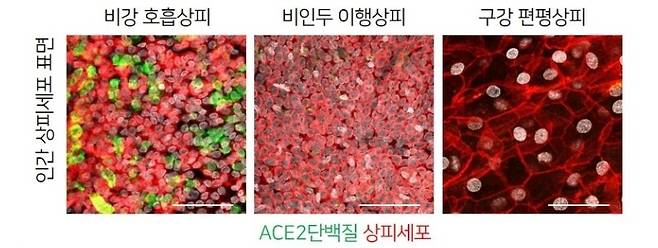 호흡기관 내 상피세포 중 ACE2 수용체 단백질(녹색)이 가장 많은 곳은 비강 상피세포다. 기초과학연구원 제공
