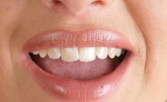 입에서 달콤하거나 불쾌한 냄새가 날 수 있다.[사진=게티이미지뱅크]