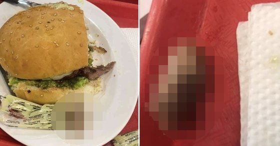 볼리비아 산타크루스 데 시에라에 위치한 햄버거 체인점에서 판매한 햄버거에서 사람 손가락이 나왔다. [트위터 캡처]