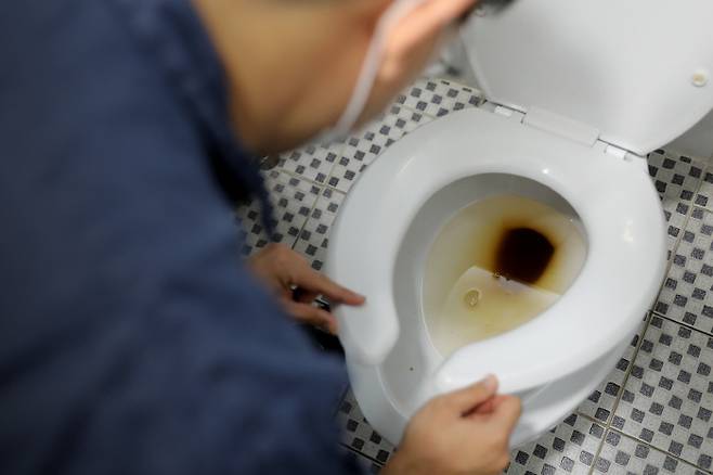 치질은 보통 선홍색 혈변이지만, 대장출혈은 '검붉은 색'을 띤다. 하지만 혈변색만으로는 대장암 구별이 어려워 대장전문의 진료로 원인을 확인해야 한다.