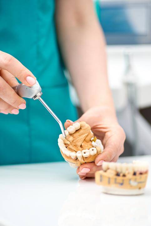 유년기에는 충치나 외상으로 치아가 빠지는 경우가 있지만, 나이가 들수록 치주염에 의한 치아 상실이 많다. 게티이미지뱅크