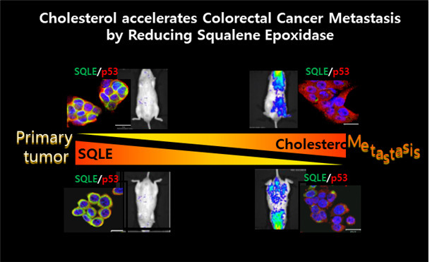 대장암 초기 SQLE(콜레스테롤 합성효소)이 높게 발현돼 콜레스테롤 합성을 증가시킨다. 대장암 세포 내에 다량의 콜레스테롤에 의해 SQLE이 분해돼 감소된다. 이로 인해 암 전이 경로가 활성화돼 대장암 전이가 촉진된다. [한국생명공학연구원 제공]