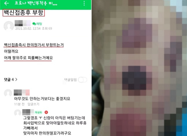 백신 부작용 관련 온라인 카페에 올라온 글. /네이버 카페