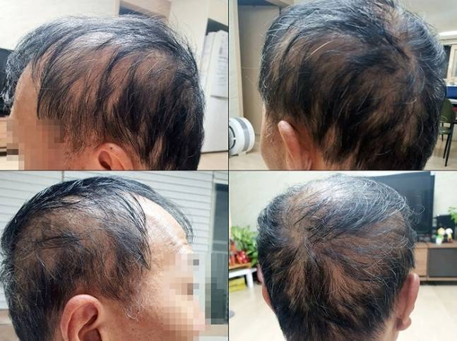 A씨 가족 제공. 연합뉴스