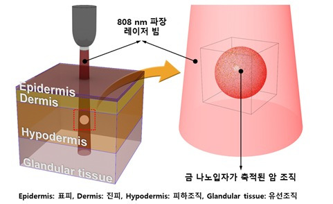 다중 층으로 구성된 유방조직에서의 금나노입자를 이용한 광열 유방암 치료 모식도(KBSI 제공) ©뉴스1