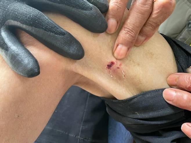 맹견에 물린 주민 [부산경찰청 제공. 재판매 및 DB 금지]