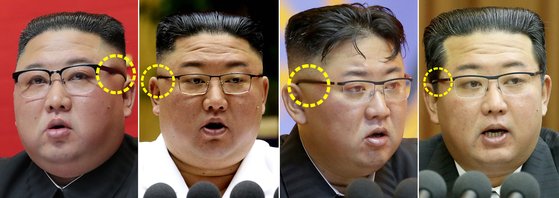 김정은 북한 국무위원장이 착용한 안경테 부근의 모습 변화. [연합뉴스]