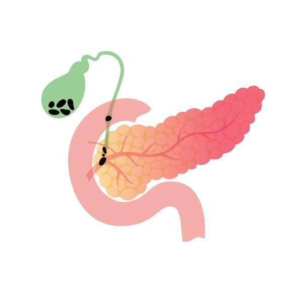 담도는 간에서 십이지장까지 연결되는 관으로 담즙을 운반하는 역할을 한다. 게티이미지뱅크